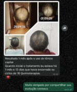 Tônico Capilar Spray para Crescimento Care&Prot 100mL - 25 dias de tratamento - Imagem 10