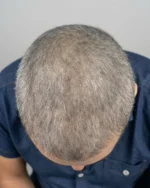 Tônico Capilar Spray para Crescimento Care&Prot 100mL - 25 dias de tratamento - Imagem 8