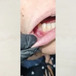 Enxaguante Hidratante da Mucosa Oral Care&Prot- 250mL - 15 dias de tratamento - Imagem 8