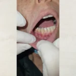 Enxaguante Hidratante da Mucosa Oral Care&Prot- 250mL - 15 dias de tratamento - Imagem 9