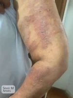 Elixir Óleo Couro Cabeludo 28mL + Organogel Hidratante Corporal 50g - Imagem 11