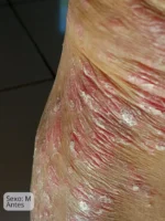 Elixir Óleo Couro Cabeludo 28mL + Organogel Hidratante Corporal 50g - Imagem 7