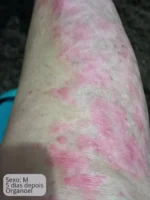 Elixir Óleo Couro Cabeludo 28mL + Organogel Hidratante Corporal 50g - Imagem 6