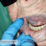 Enxaguante Hidratante da Mucosa Oral Care&Prot- 250mL - 15 dias de tratamento - Imagem 6