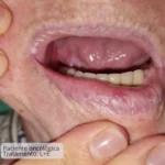 Enxaguante Hidratante da Mucosa Oral Care&Prot- 250mL - 15 dias de tratamento - Imagem 7